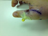 thumb.jpg