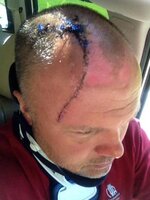 Tucks head injury.jpg